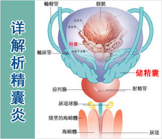 [安庆男科去哪家医院看比较好]造成安庆男性患上精囊炎的原因有哪些？